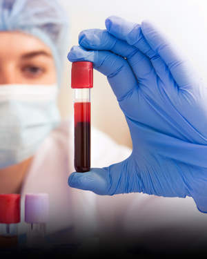 "Your Labs Are Fine": Why TSH Alone Is Not a Complete Thyroid Test